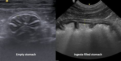 normal cat stomach ultrasound